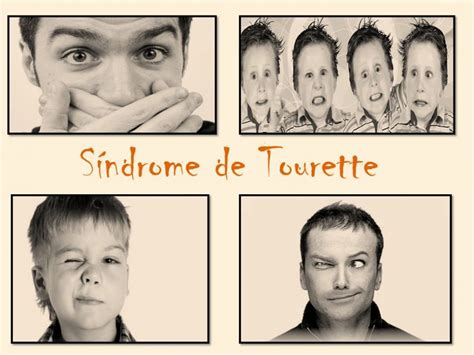 Video La importancia de conocer qué es el Síndrome de Tourette