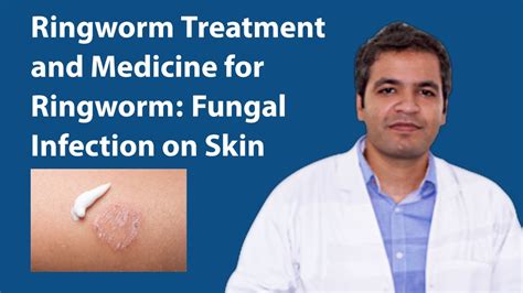 Ringworm Treatment Fungal Infection On Skin Symptoms Reason And