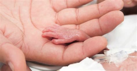 Baby Born At 22 Weeks Gestation Proves The Resilience Of