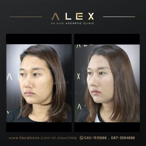 ปักพินโดย Dr Alex Aesthetic Clinic ใน Thailand Plastic Surgery