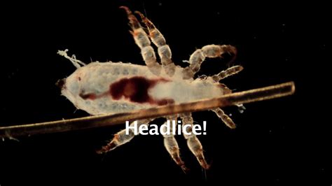Head Lice Microscopic View Youtube