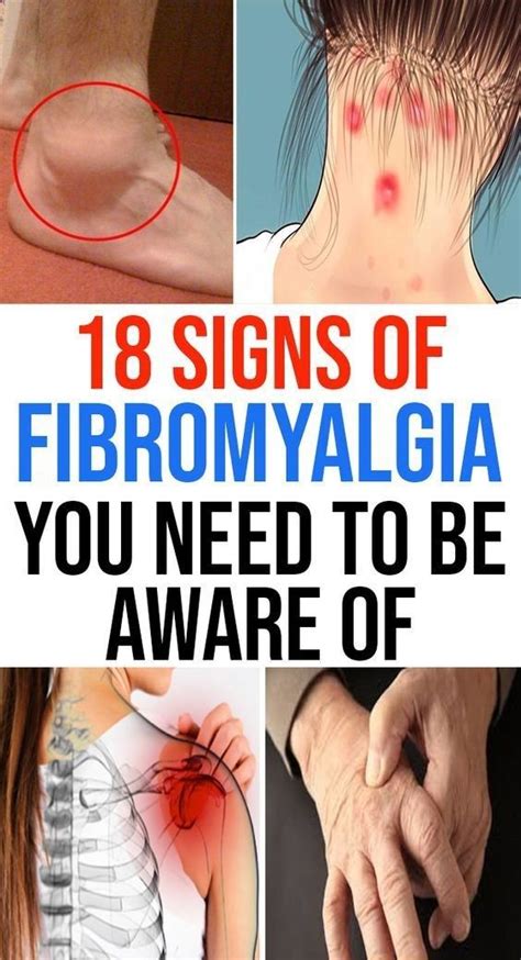 43 Signs Of Fibromyalgia You Should Be Aware Of Outstanding Signs Of