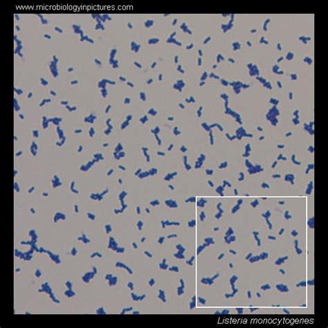 Listeria Monocytogenes Gram Stain Morphology The Best Porn Website