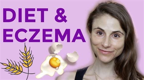 Diet And Supplements For Eczema Qanda With Dermatologist Dr Dray Youtube