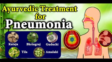 Ayurvedic Treatment For Pneumonia Herbs For Pneumonia Ingenious