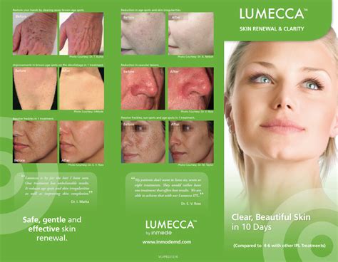Lumecca Ipl Treatments Sherman Oaks Ca Pure Touch Skin Center