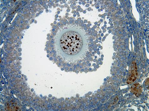 Ovary Cat 400 X