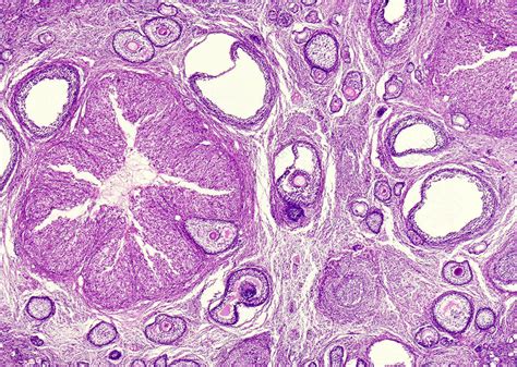 Graafian Follicles In A Mature Ovary Light Micrograph Stock Image
