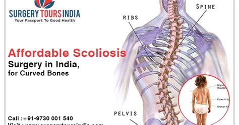 scoliosis surgery in india scoliosis surgery cost india