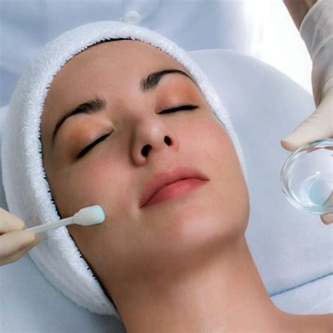 Using Chemical Peels At Home 5 Things You Should Know