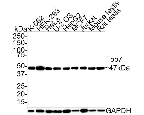 Tbp7 Recombinant Rabbit Monoclonal Antibody Je62 72 Ha721435 Huabio