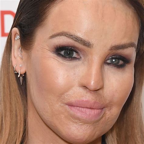 Katie Piper Latest News Pictures And Videos Hello