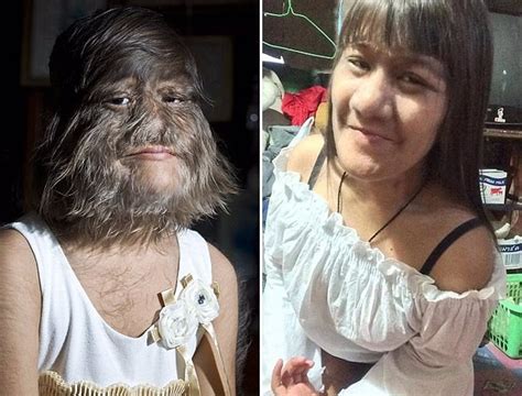 La Mujer Más Peluda Del Mundo Ha Mostrado Su Rostro Afeitado Por