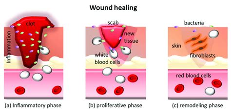 Schematic Of The Three Phases Of The Wound Healing Process Download