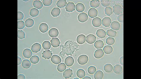 White Blood Cells Under Microscope Labeled
