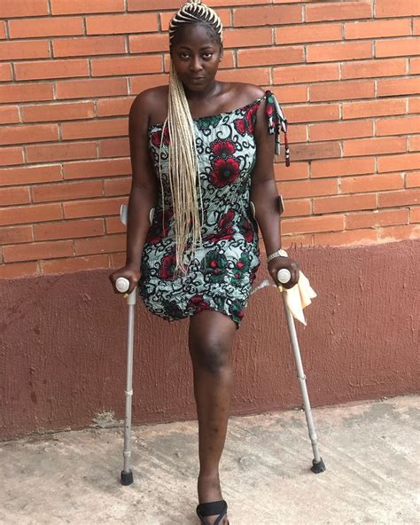 Check Out A List Of Nollywood Stars Who Lost Their Leg See Photos