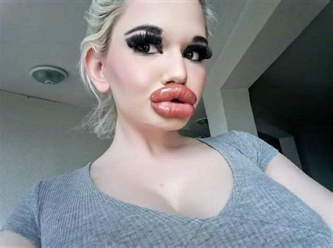 Andrea Ivanova The Woman With The Biggest Lips In The World