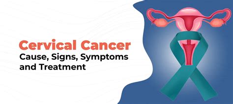 Cervical Cancer Causes Signs Symptoms And Treatment Rocket Health