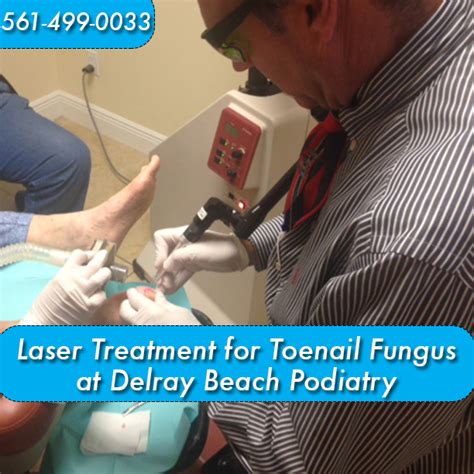 Laser Treatment For Fungal Nails At Delray Beach Podiatry Delray