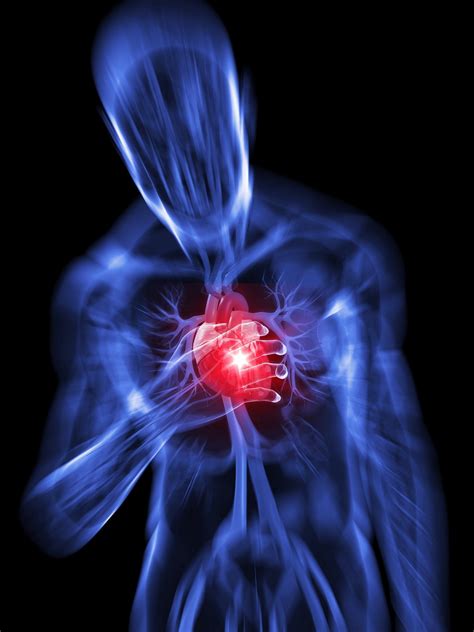 Reducing Damage After A Heart Attack • Healthcare In