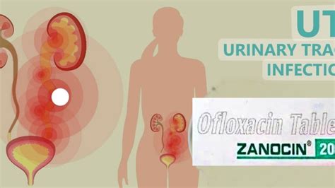 Uti Infection Treatment Zanocin Tablet Use In Hindi Youtube