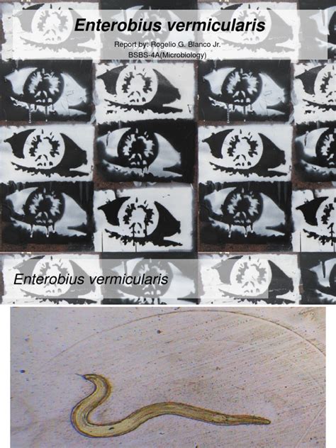 El enterobius vermicularis es un parásito muy común en los niños, a diferencia de otros gusanos intestinales es el único que necesita salir del cuerpo para. Enterobius vermicularis | Clinical Medicine | Medicine