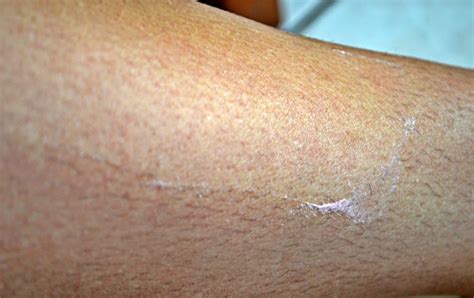 Underarm hair removal can be painful if you're used to shaving every day. 38 HQ Pictures How Long Should Armpit Hair Be To Wax ...