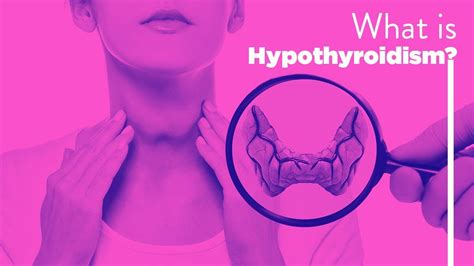 What Is Hypothyroidism Youtube