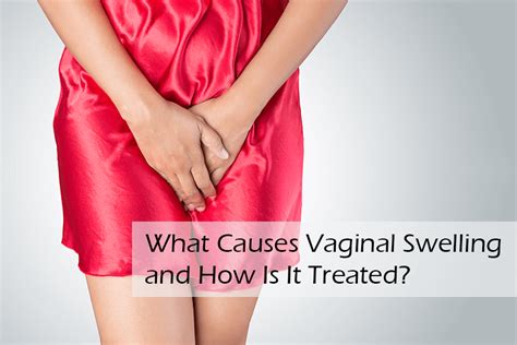 What Causes Vaginal Swelling And How Is It Treated