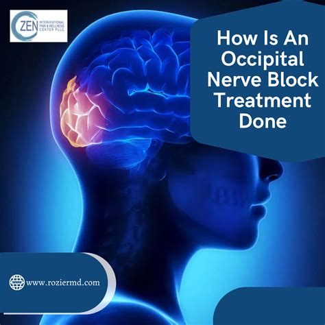 How Is An Occipital Nerve Block Treatment Done In Fort Worth Tx