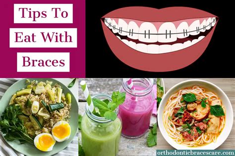 How To Eat And Chew With Braces Top 19 Simple Tips Orthodontic