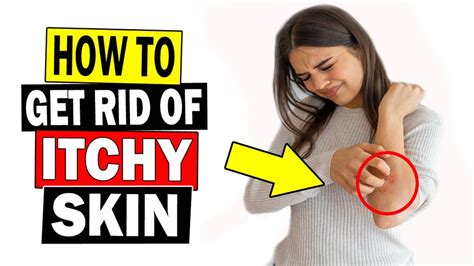 How To Get Rid Of Itchy Skin Fast Home Remedies For Itchy Skin