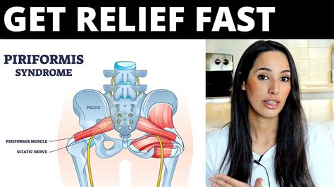 Piriformis Syndrome Tips To Get Fast Relief No Exercises Or Stretches Youtube