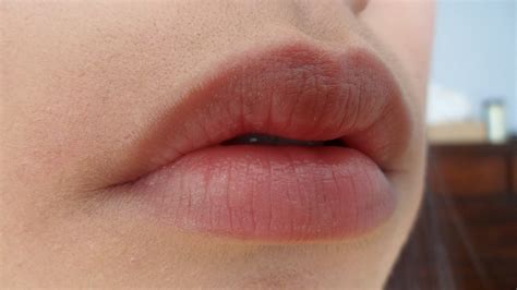 What Does Your Natural Lip Color Say About Your Health Know Here