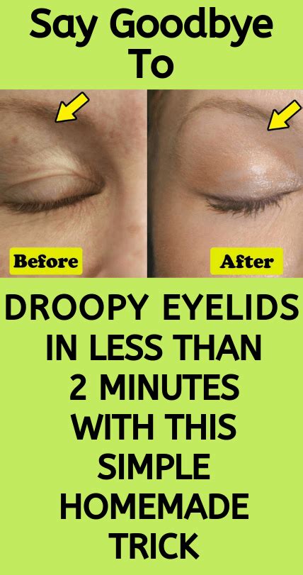 Get Rid Of Droopy Eyelids In Less Than 2 Minutes With This Simple