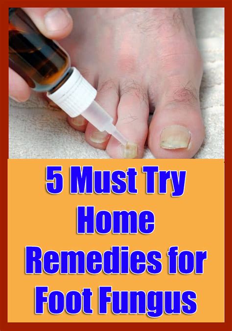 5 Must Try Home Remedies For Foot Fungus In 2020 Home Remedies Foot Fungus Remedies Remedies