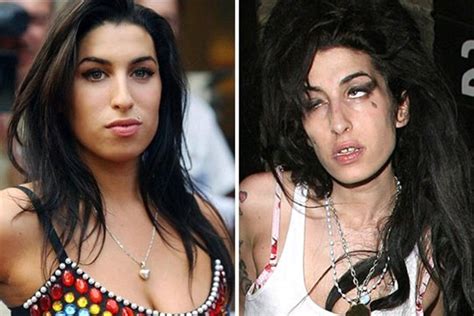 Amy Winehouse Sus Impactantes Fotos Antes Y Despu S De Su Adicci N Al Alcohol Y Las Drogas