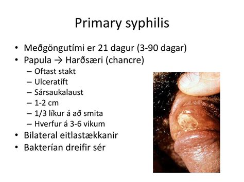 Ppt Sárasótt Syphilis Powerpoint Presentation Free Download Id2087684