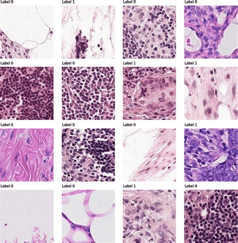 Sample Images Of Histopathologic Scans Of Lymph Node Sections Label Download Scientific