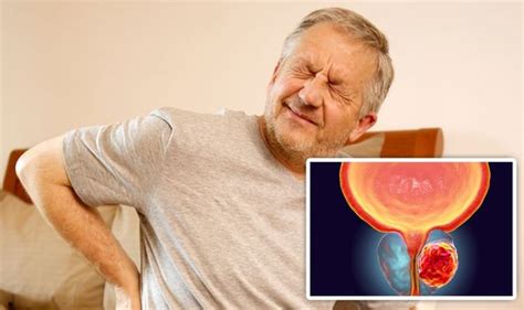 Prostate Cancer Symptoms Pain In The Back Prostate Cancer Wikipedia
