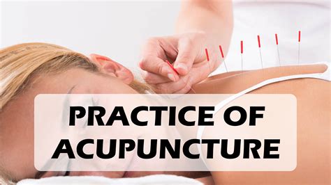 Practice Of Acupuncture