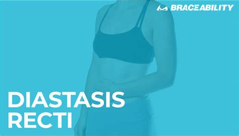 A Complete Guide To Diastasis Recti Truths On Abdominal Separation