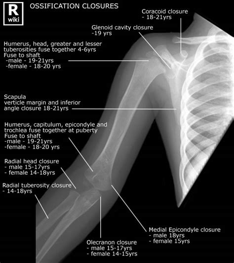Humerus Anatomy X Ray
