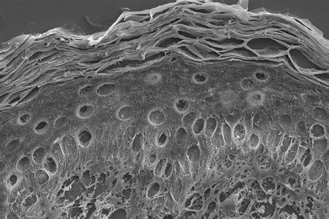Visualizing Skin Tissue Morphology With Scanning Electron Microscopy