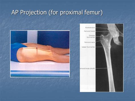 Radiographic Positioning Of The Femur And Tib Fib Ce4rt