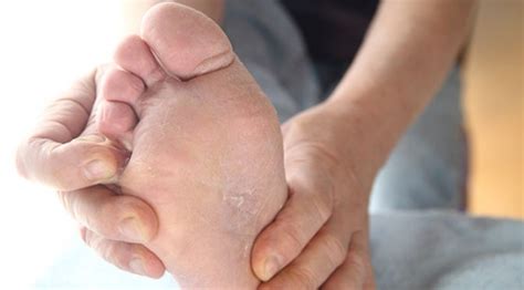 Potential Causes Of Itchy Feet