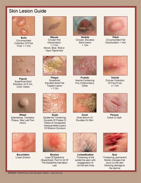 12 Best Images About Laboratory Diagnosis Of Infections On Pinterest
