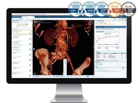 Medical Image Sharing And Exchange Solutions Philips Healthcare