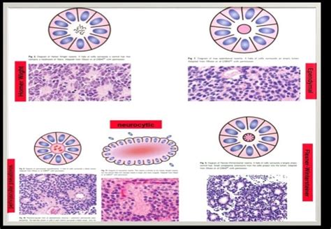 Patterns In Histopathology