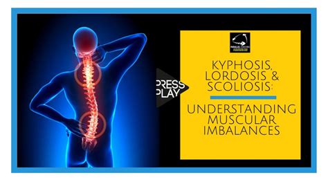 Kyphosis Lordosis And Scoliosis Understanding Muscular Imbalances My